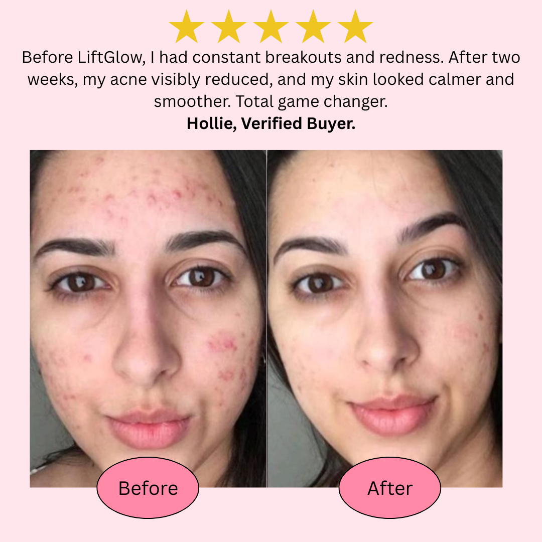 Glèmoire™ LiftGlow