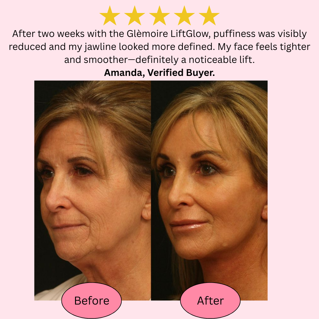Glèmoire™ LiftGlow