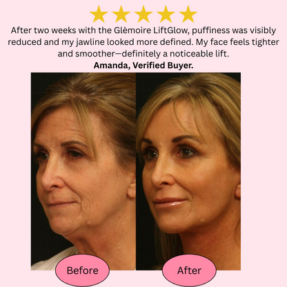 Glèmoire™ LiftGlow